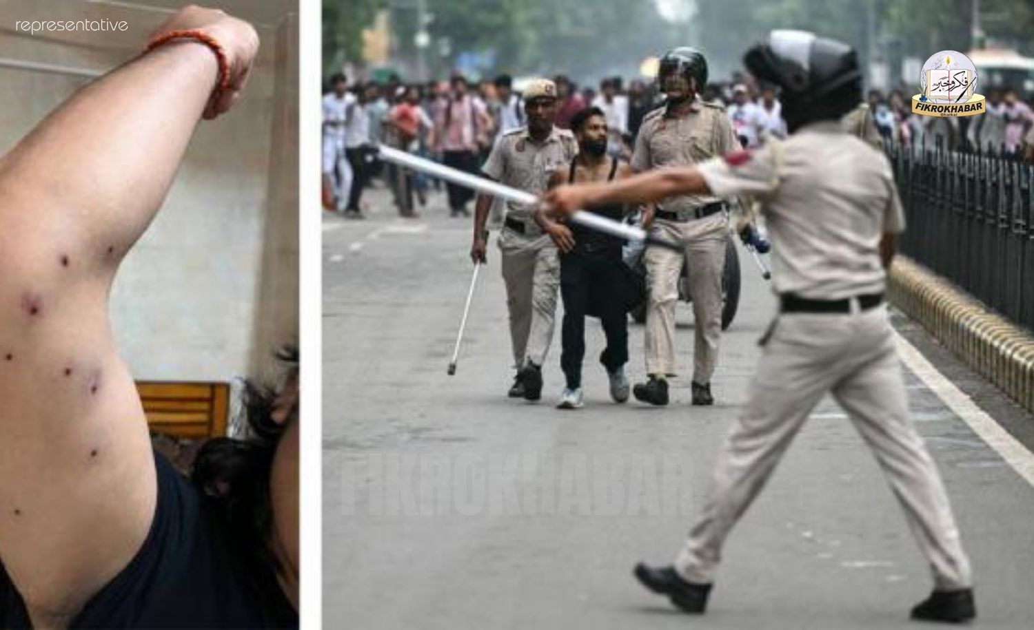 Delhi Parliament March: RTI Reveals 10 Protesters Injured by Pellet Gun Fire